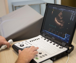 NOVA SANTA CASA DE MISERICÓRDIA OFERECE EXAMES DE ECOCARDIOGRAMA