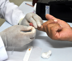 TESTES RÁPIDOS DE HIV, SÍFILIS E HEPATITE B E C SÃO REALIZADOS PELA PREFEITURA DE RESENDE NESTA QUARTA-FEIRA